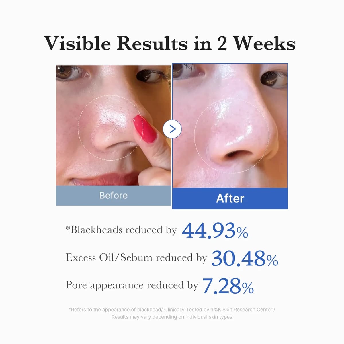 ميديكيوبي وسادات تنظيف المسام الزرقاء – Medicube Zero Pore Pad — صورة 4